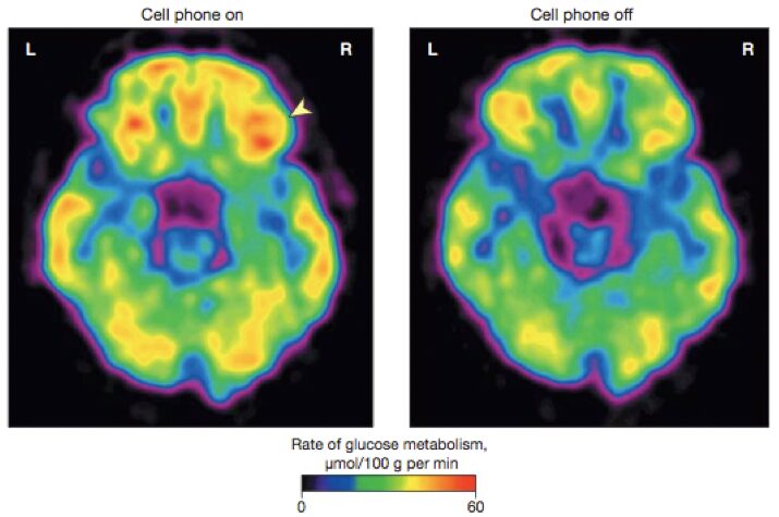 smartphone is dangerous for brain