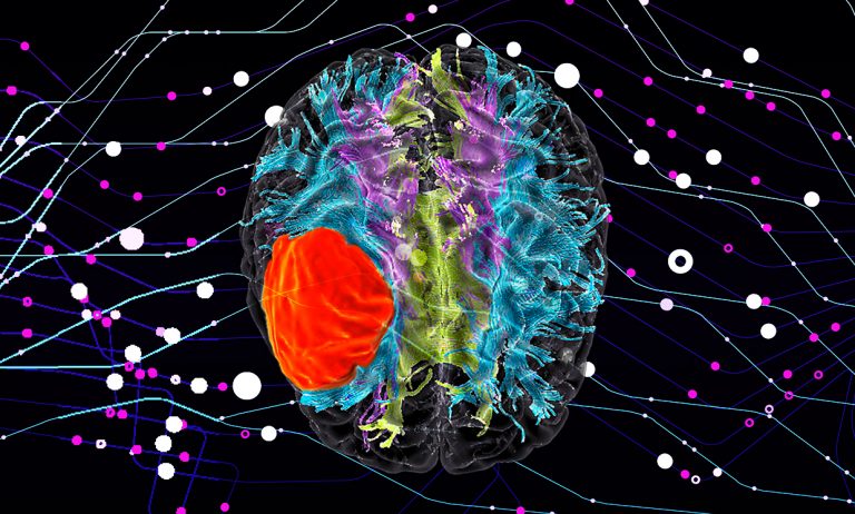 How AI can be Humanity’s First Line of Defense Against Cancer