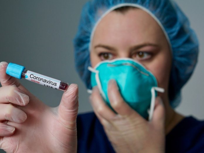 COVID-19 tests in the US