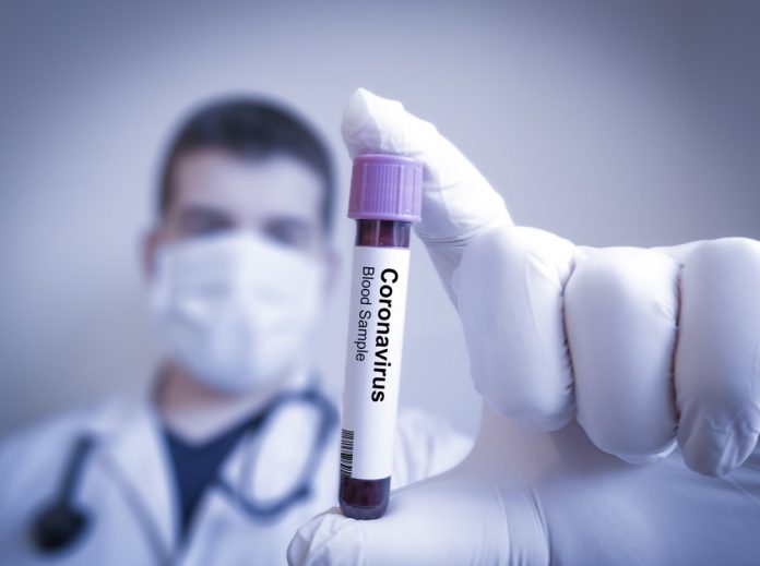 Coronavirus Outbreak - Infomance 9 Coronavirus Outbreak