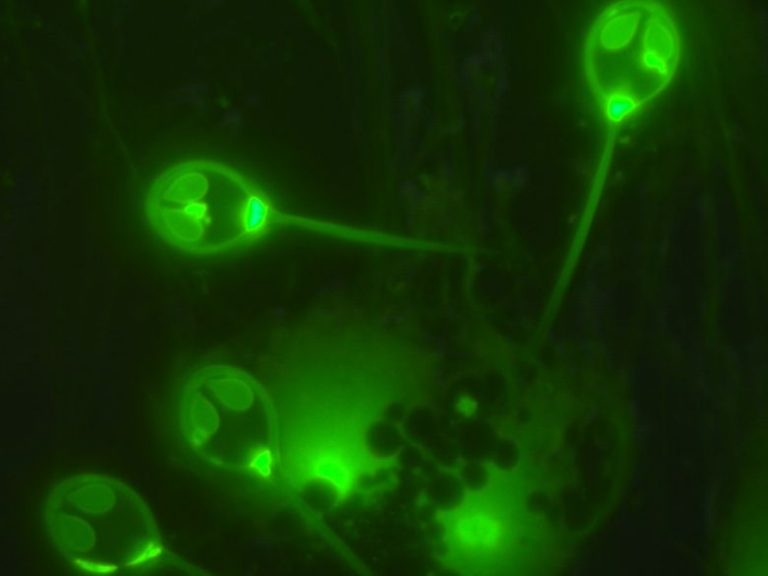 An Organism That Can Survive Without Oxygen!