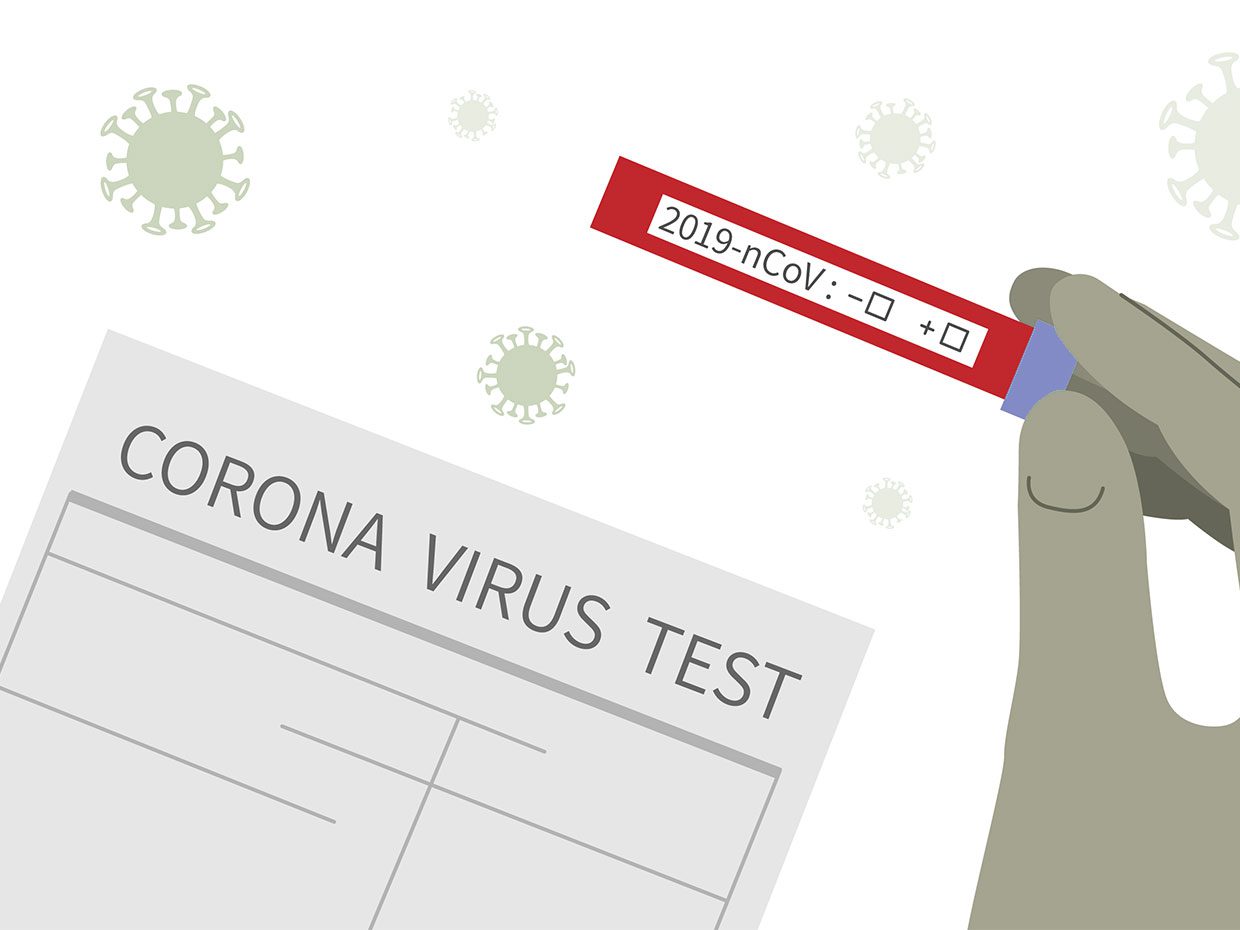 Bill Gates backed coronavirus testing program- Infomance