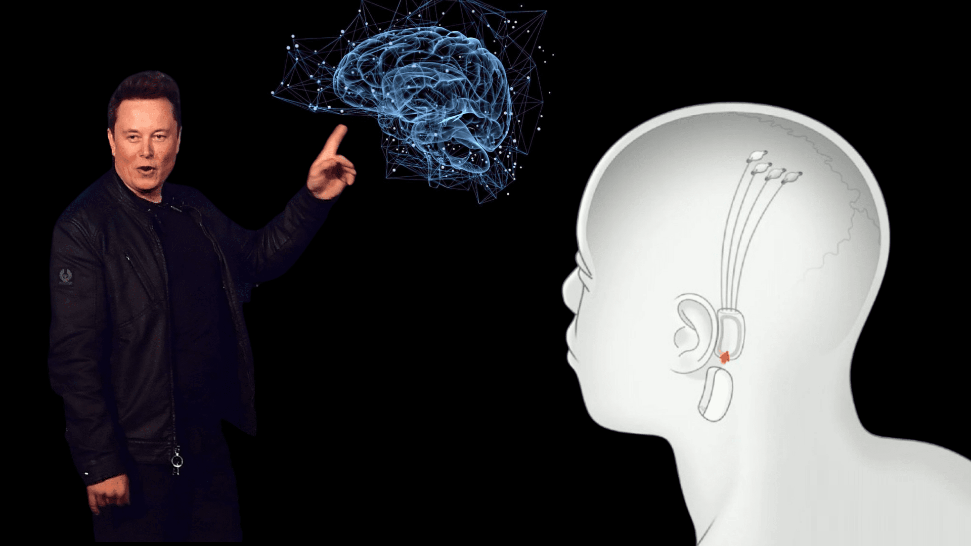 Neuralink Neuralink